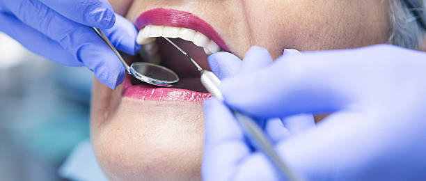 Best Dentist for Tooth Abscess  in Hyde Park, UT